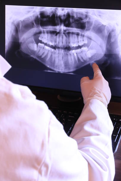Best Pediatric Emergency Dentist in Hillsborough, NJ